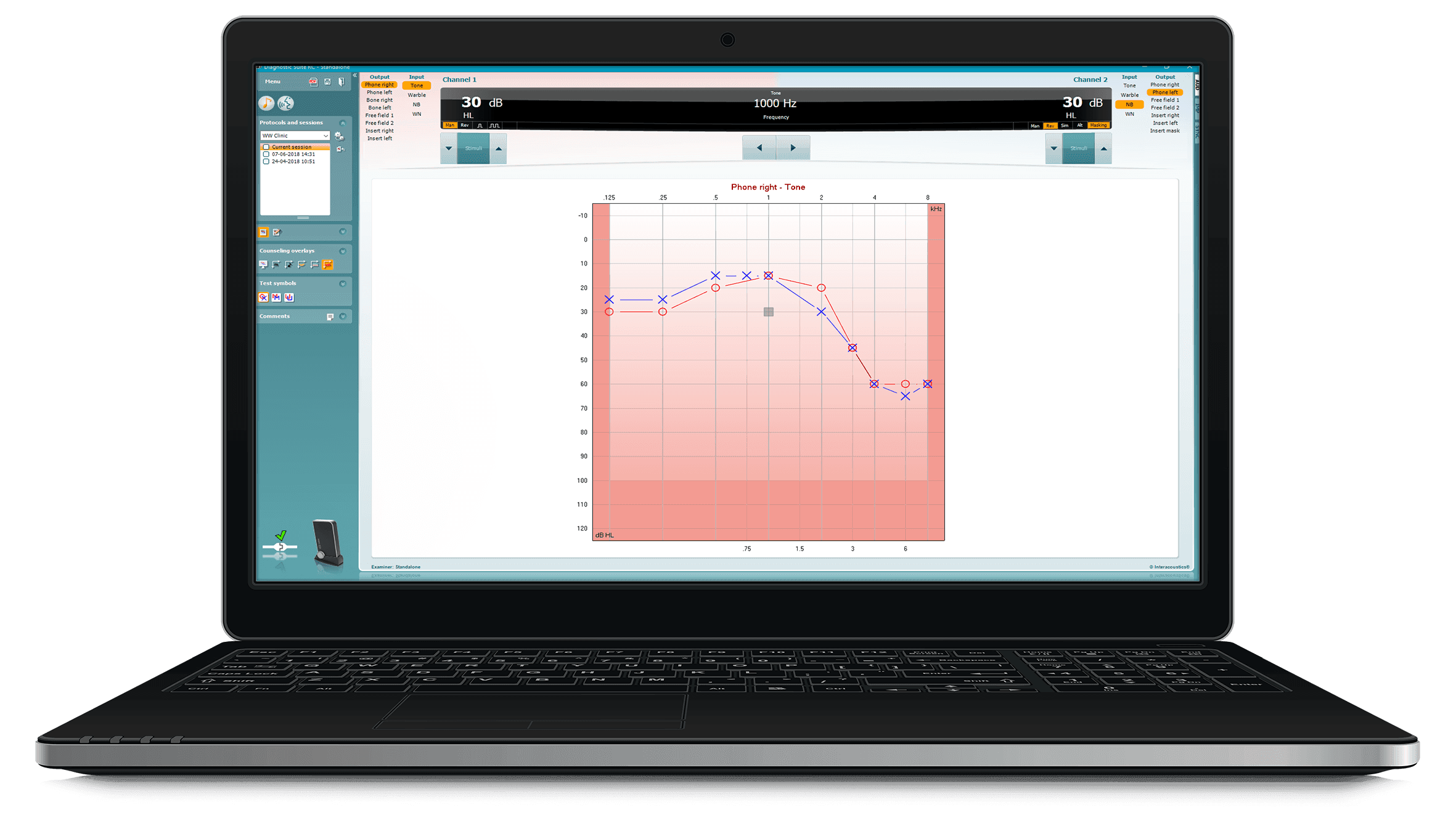 xcallisto-screens_laptop-copy